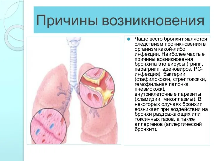 Причины возникновения Чаще всего бронхит является следствием проникновения в организм какой-либо