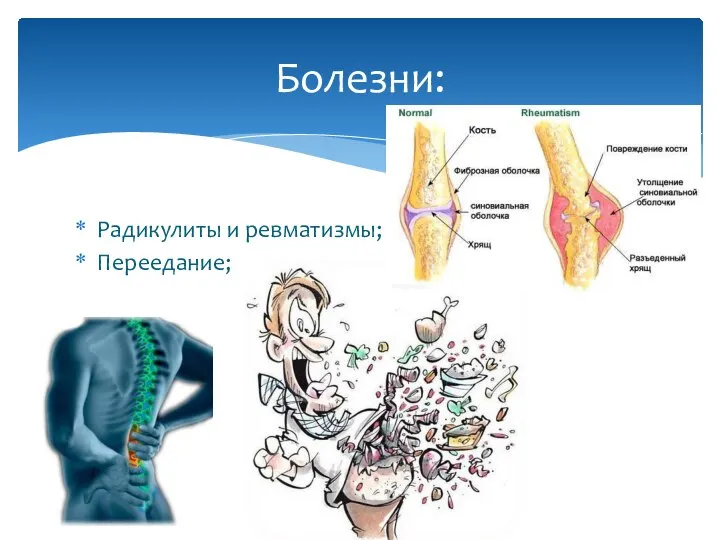 Радикулиты и ревматизмы; Переедание; Болезни: