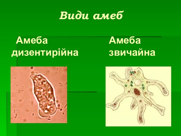 Види амеб Амеба дизентирійна Амеба звичайна