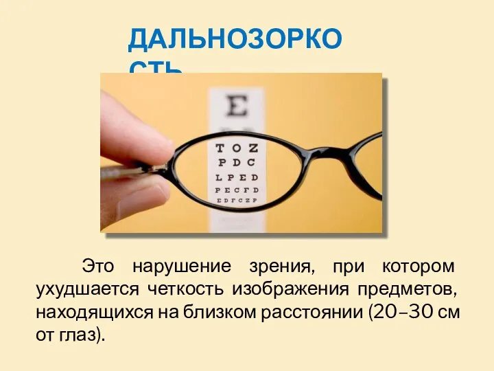 Это нарушение зрения, при котором ухудшается четкость изображения предметов, находящихся на