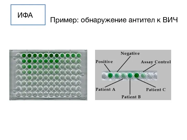 ИФА Пример: обнаружение антител к ВИЧ