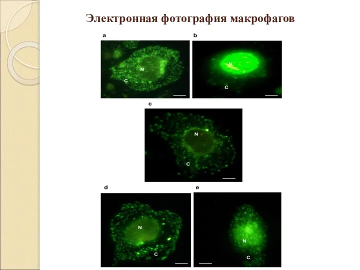 Электронная фотография макрофагов