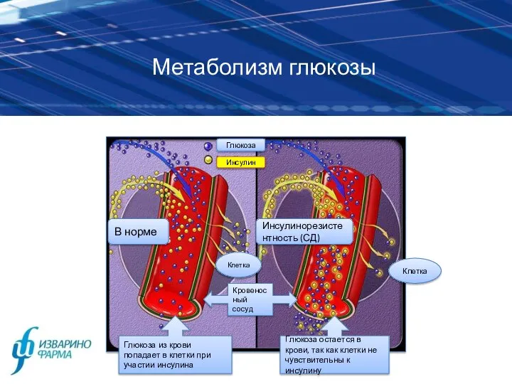 Метаболизм глюкозы В норме Инсулинорезистентность (СД) Глюкоза из крови попадает в