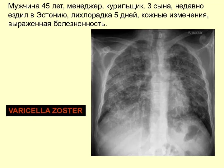 Мужчина 45 лет, менеджер, курильщик, 3 сына, недавно ездил в Эстонию,