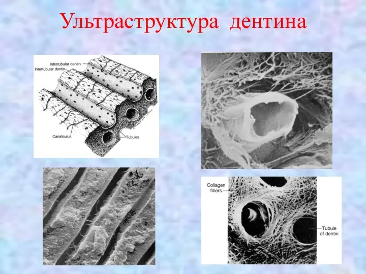 Ультраструктура дентина