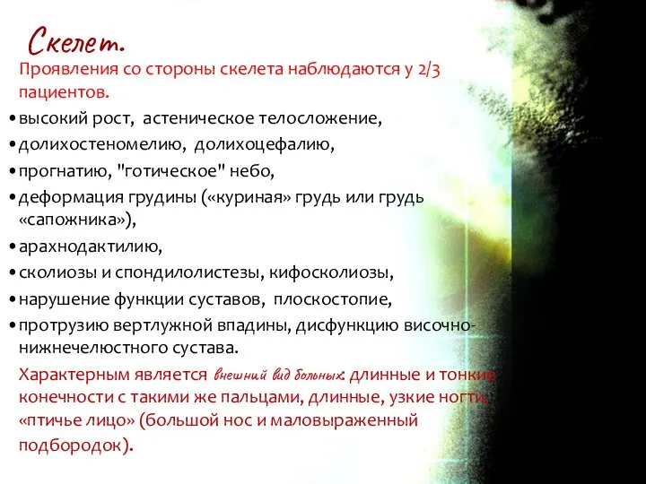 Проявления со стороны скелета наблюдаются у 2/3 пациентов. высокий рост, астеническое