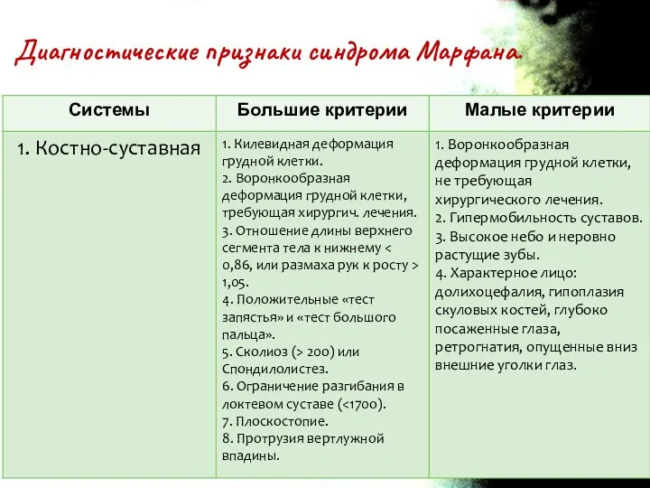 Диагностические признаки синдрома Марфана.