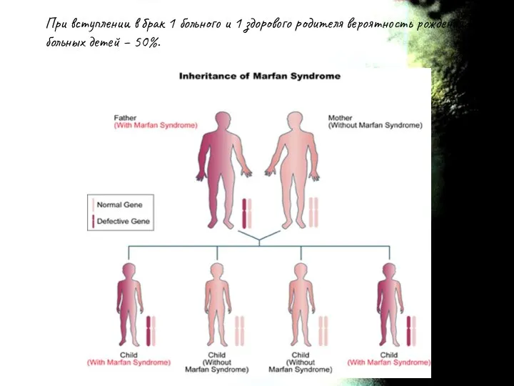 При вступлении в брак 1 больного и 1 здорового родителя вероятность рождения больных детей – 50%.