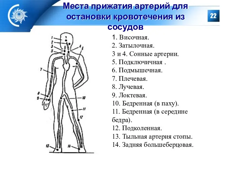 Места прижатия артерий для остановки кровотечения из сосудов 1. Височная. 2.