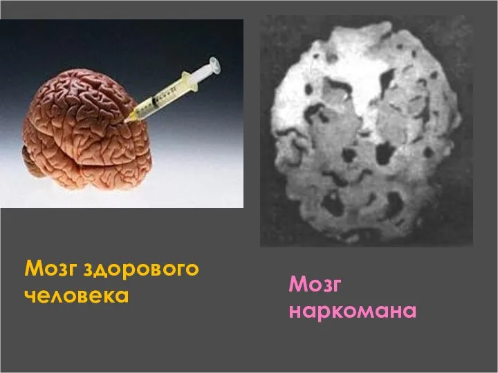 Мозг наркомана Мозг здорового человека