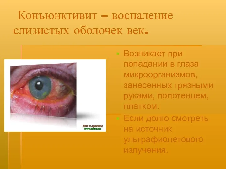 Конъюнктивит – воспаление слизистых оболочек век. Возникает при попадании в глаза