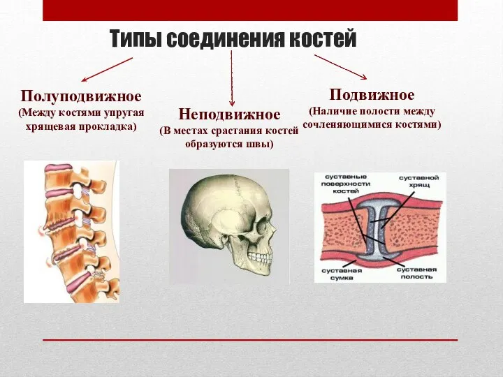 Типы соединения костей Полуподвижное (Между костями упругая хрящевая прокладка) Неподвижное (В