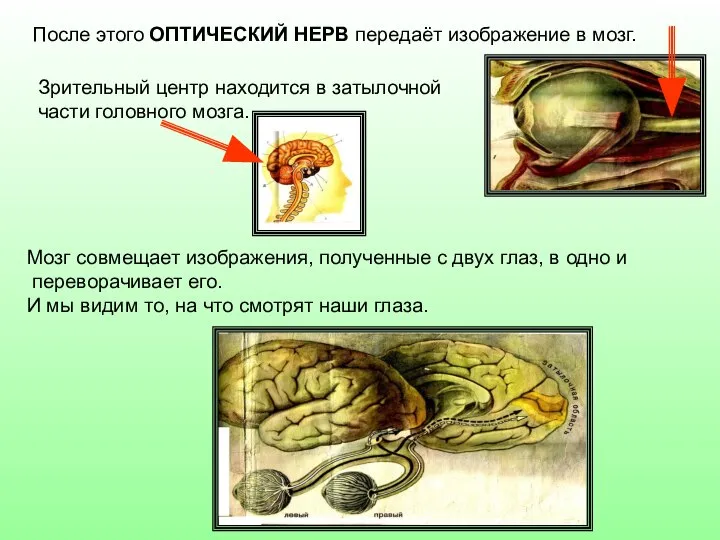 После этого ОПТИЧЕСКИЙ НЕРВ передаёт изображение в мозг. Зрительный центр находится