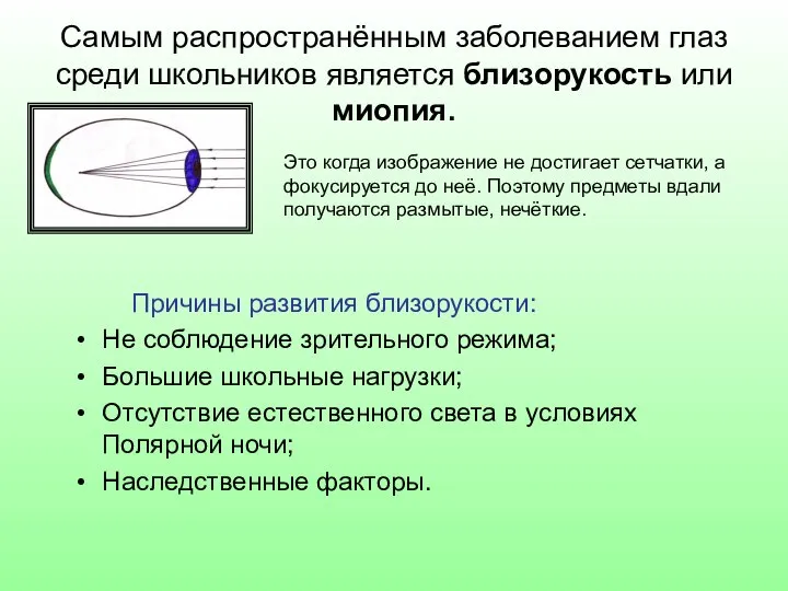 Самым распространённым заболеванием глаз среди школьников является близорукость или миопия. Причины