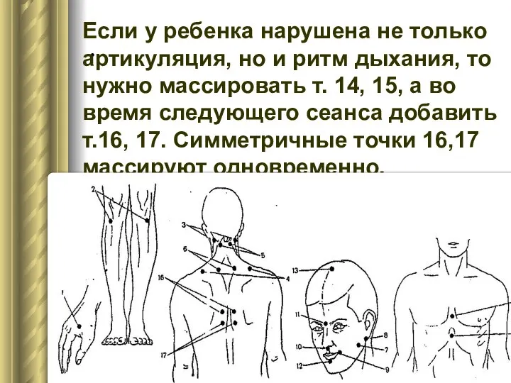 . Если у ребенка нарушена не только артикуляция, но и ритм