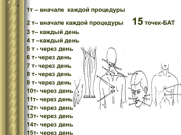 . 1т – вначале каждой процедуры 2 т– вначале каждой процедуры