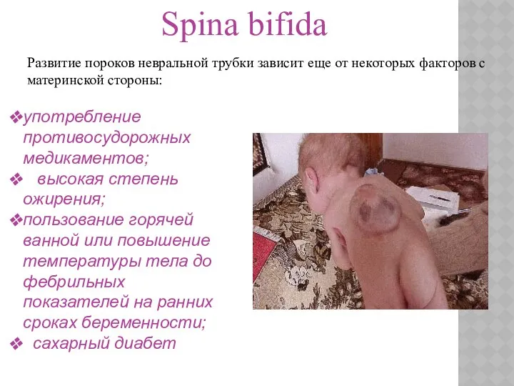 Spina bifida употребление противосудорожных медикаментов; высокая степень ожирения; пользование горячей ванной