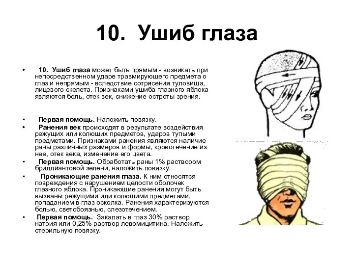 10. Ушиб глаза 10. Ушиб глаза может быть прямым - возникать