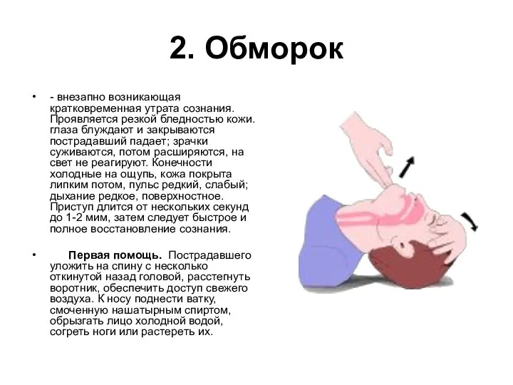 2. Обморок - внезапно возникающая кратковременная утрата сознания. Проявляется резкой бледностью