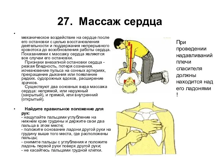 27. Массаж сердца механическое воздействие на сердце после его остановки с