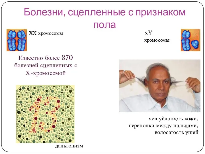 Болезни, сцепленные с признаком пола ХХ хромосомы ХY хромосомы Известно более