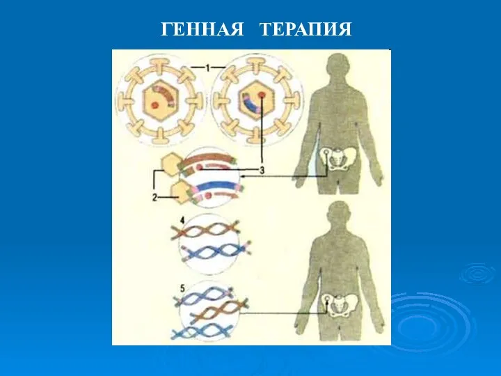 ГЕННАЯ ТЕРАПИЯ