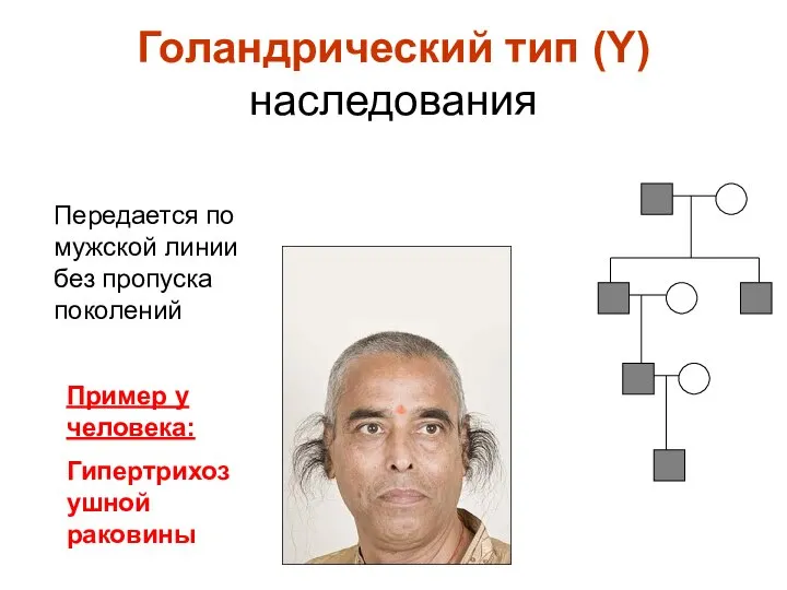 Голандрический тип (Y) наследования Передается по мужской линии без пропуска поколений