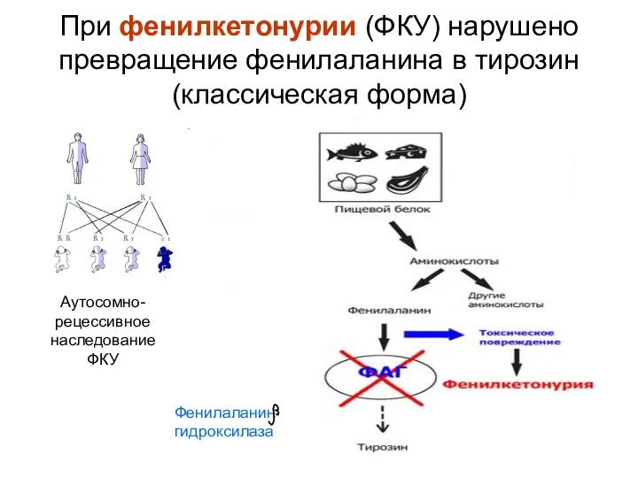 При фенилкетонурии (ФКУ) нарушено превращение фенилаланина в тирозин (классическая форма) Фенилаланин гидроксилаза Аутосомно-рецессивное наследование ФКУ