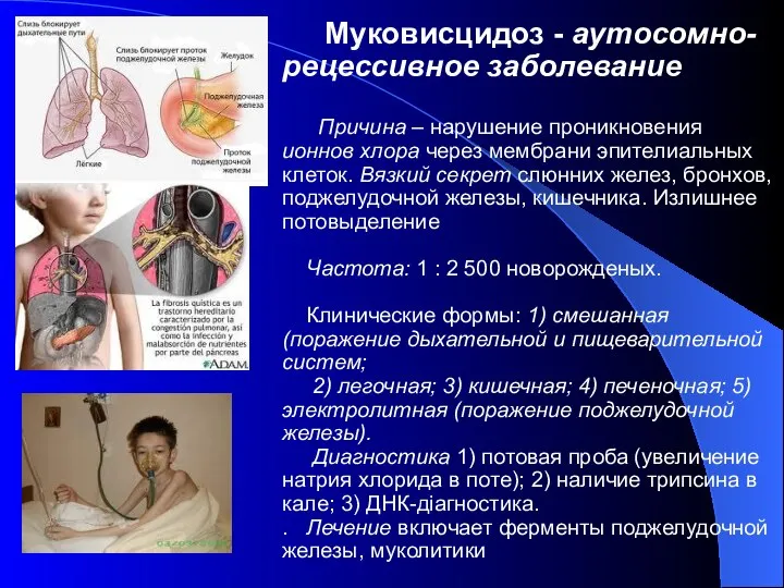 Муковисцидоз - аутосомно-рецессивное заболевание Причина – нарушение проникновения ионнов хлора через