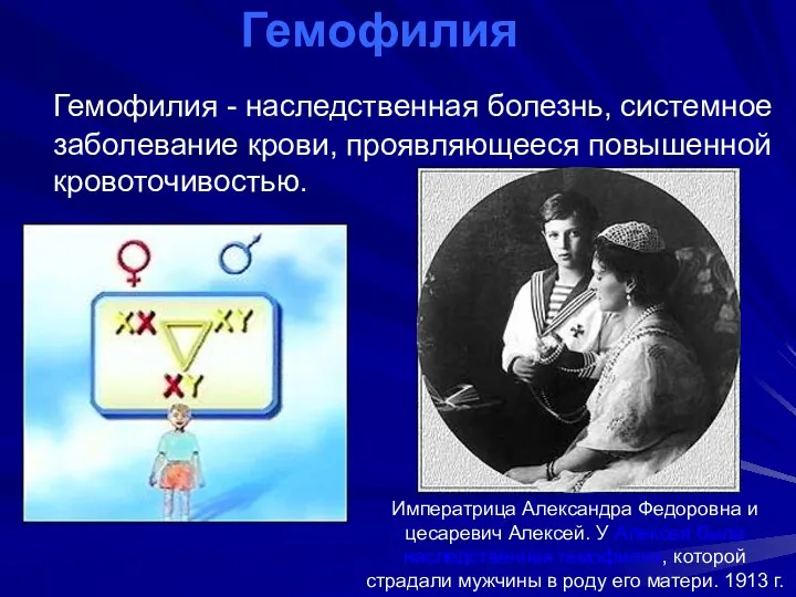 Гемофилия Гемофилия - наследственная болезнь, системное заболевание крови, проявляющееся повышенной кровоточивостью.