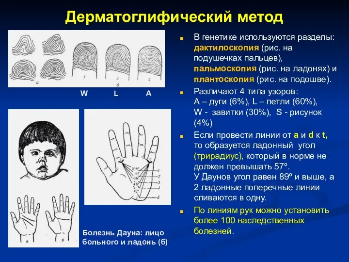Дерматоглифический метод В генетике используются разделы: дактилоскопия (рис. на подушечках пальцев),