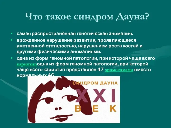 Что такое синдром Дауна? самая распространённая генетическая аномалия. врожденное нарушение развития,