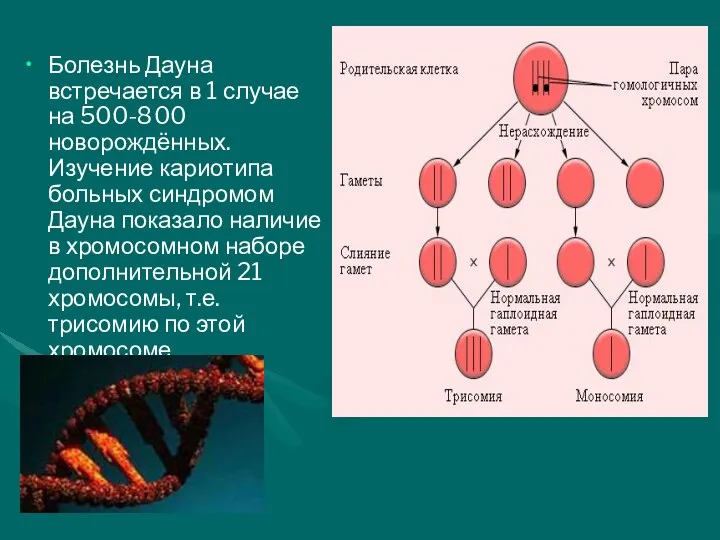 Болезнь Дауна встречается в 1 случае на 500-800 новорождённых. Изучение кариотипа