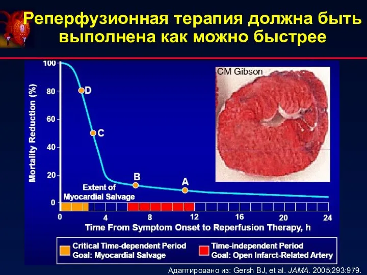 Реперфузионная терапия должна быть выполнена как можно быстрее Адаптировано из: Gersh BJ, et al. JAMA. 2005;293:979.