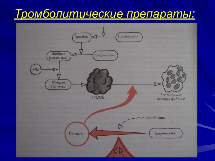 Тромболитические препараты: