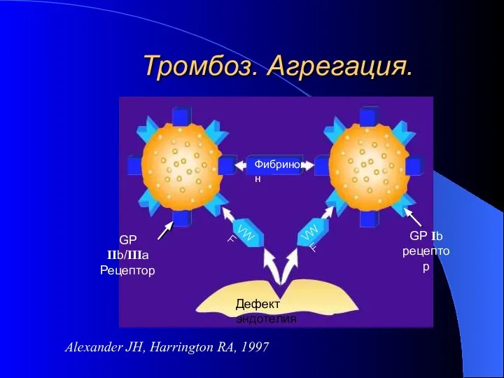 Тромбоз. Агрегация. Alexander JH, Harrington RA, 1997 Дефект эндотелия Фибриноген VWF