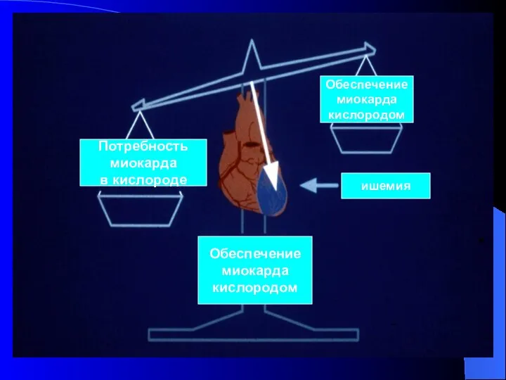 Потребность миокарда в кислороде Обеспечение миокарда кислородом ишемия Обеспечение миокарда кислородом