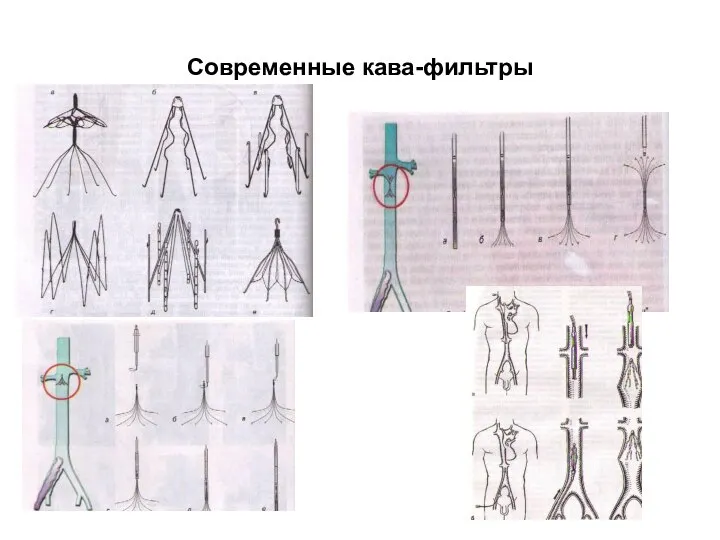 Современные кава-фильтры