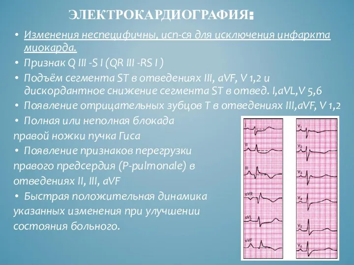 ЭЛЕКТРОКАРДИОГРАФИЯ: Изменения неспецифичны, исп-ся для исключения инфаркта миокарда. Признак Q III