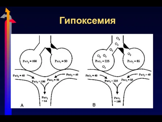 Гипоксемия