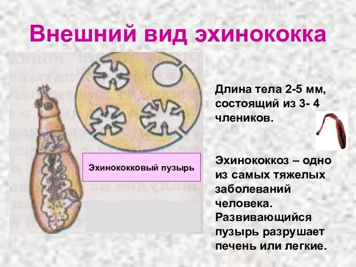 Внешний вид эхинококка Длина тела 2-5 мм, состоящий из 3- 4