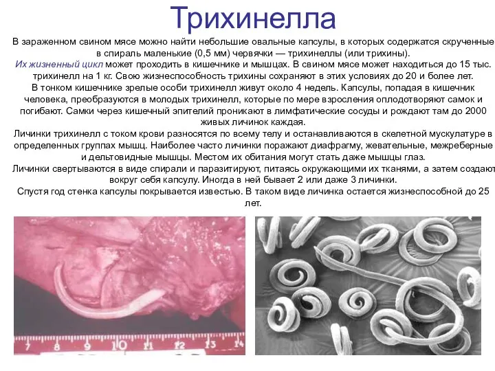 Трихинелла В зараженном свином мясе можно найти небольшие овальные капсулы, в