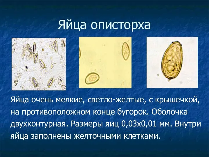 Яйца описторха Яйца очень мелкие, светло-желтые, с крышечкой, на противоположном конце