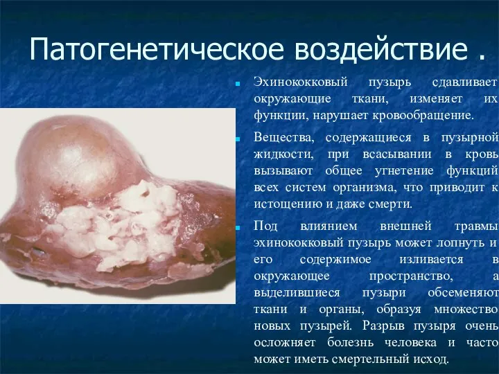 Патогенетическое воздействие . Эхинококковый пузырь сдавливает окружающие ткани, изменяет их функции,