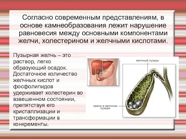 Согласно современным представлениям, в основе камнеобразования лежит нарушение равновесия между основными