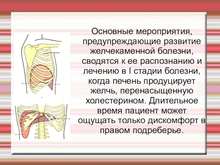 Основные мероприятия, предупреждающие развитие желчекаменной болезни, сводятся к ее распознанию и