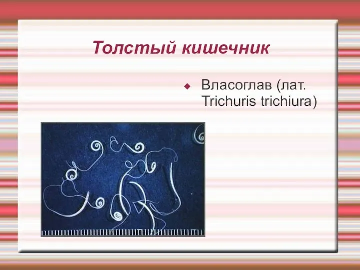 Толстый кишечник Власоглав (лат. Trichuris trichiura)