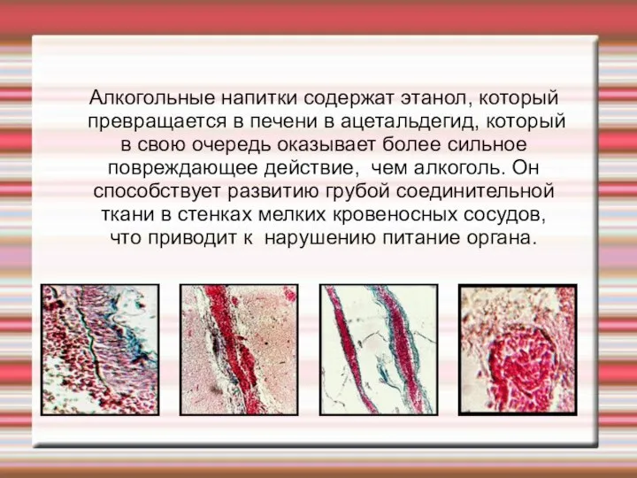 Алкогольные напитки содержат этанол, который превращается в печени в ацетальдегид, который