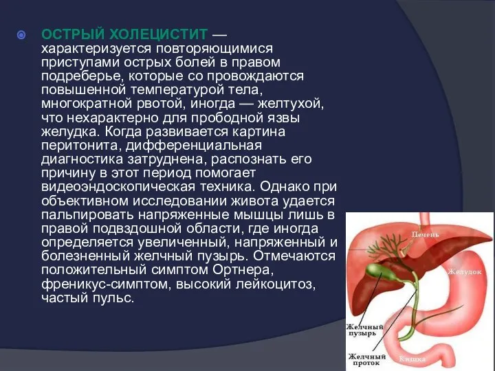 Острый холецистит — характеризуется повторяющимися приступами острых болей в правом подреберье,