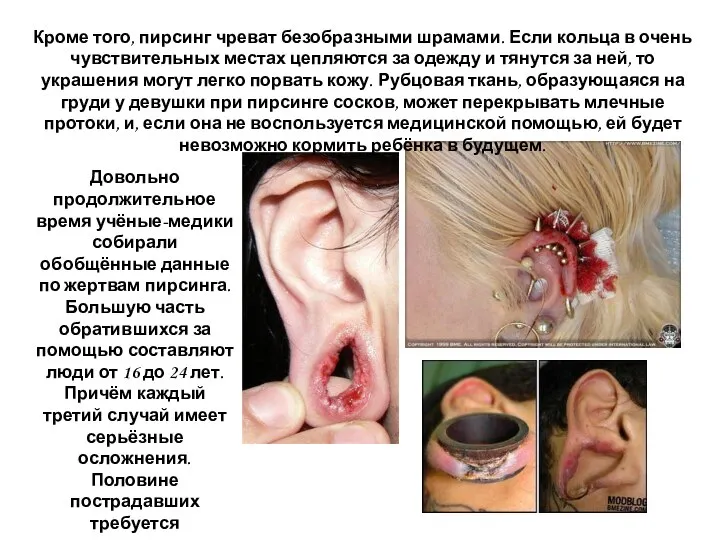 Довольно продолжительное время учёные-медики собирали обобщённые данные по жертвам пирсинга. Большую